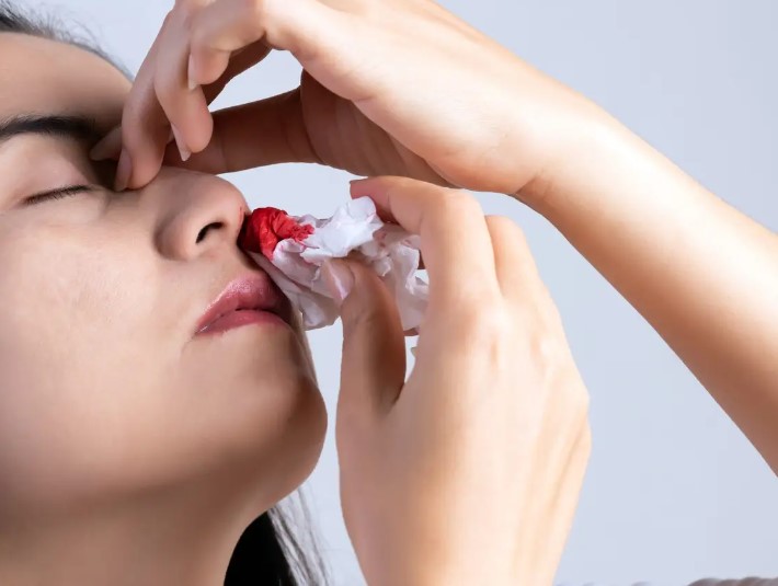 Learn How To Stop Nose Bleed