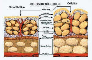 formation_of_cellulite