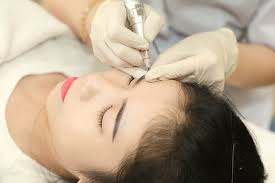 Is microdermabrasion worth the money