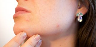 dermatologos treatment for dark spots on face