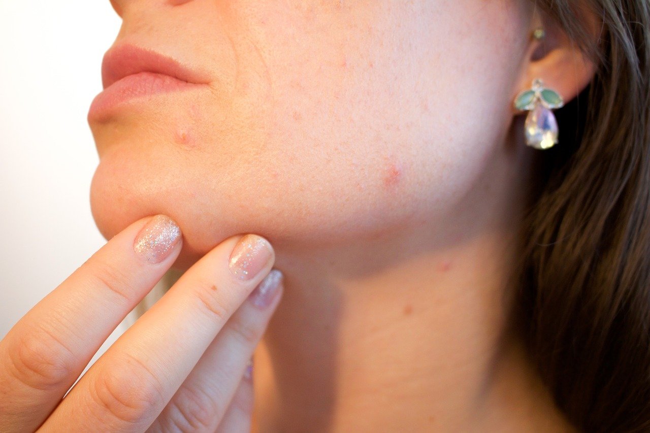 dermatologos treatment for dark spots on face